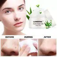 چسب بینی ضد جوش سرسیاه لانبنا