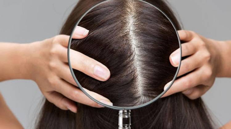 علت پوسته سر بعد از کراتین مو چیست؟